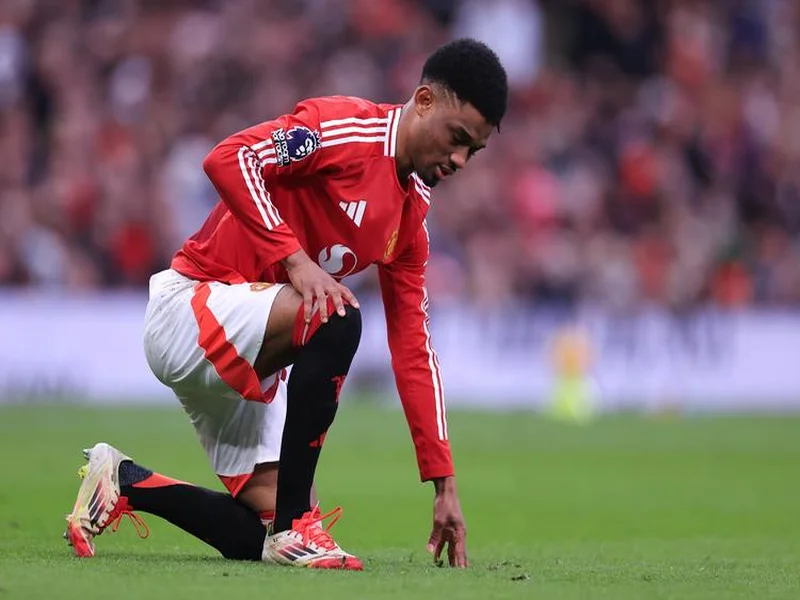 TA:曼联球员多古腿筋受伤,预计伤缺10周